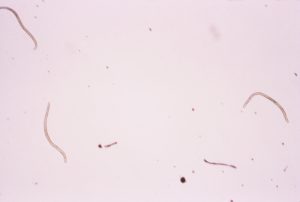 Microfilariae of Onchocerca volvulus, the parasitic worm responsible for river blindness.